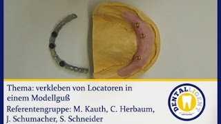 ZahntechnikKonventionellLocatorMatritzen in einem Modellguss verkleben [upl. by Gladdy]