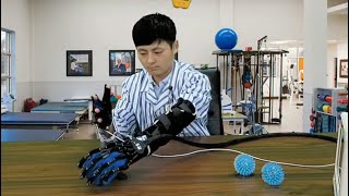 Robotic Hand After Stroke Rehabilitation Exercise [upl. by Nodearb]