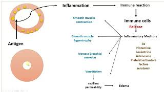 bronchial asthma PTBU [upl. by Meredeth]