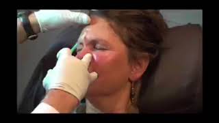 Lynne Koplitz Does Botox With Doctor Bill [upl. by Jaycee]