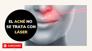 El ACNÉ NO se trata con LÁSER [upl. by Carlina]