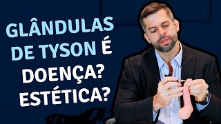 Glândulas de Tyson é doença Estética  Dr Marco Túlio  Urologista e Andrologista [upl. by Anelehs]