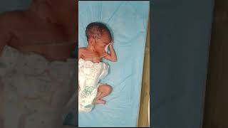 obed This newborn baby Hypotonia lack of healthy mother this newborn baby very thin body [upl. by Eihs]