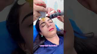 Laser Hair Removal getsmarthairclub beauty hair [upl. by Carmela971]