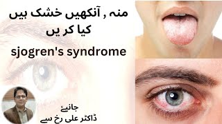 Sjogrens Syndrome symptoms and treatment by Dr Alirukhمنہ ، آنکھیں خشک ہیں کیا کریں ۔ sjogrens [upl. by Mir15]