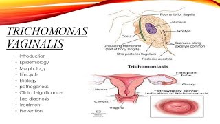 Trichomonas vaginalis [upl. by Airetal]