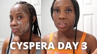 Cyspera Cysteamine Day 3  My Daily Melasma  Hyperpigmentation Skin Care Routine [upl. by Ednihek]