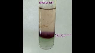 Molisch Testa group test for Carbohydrates [upl. by Quackenbush]