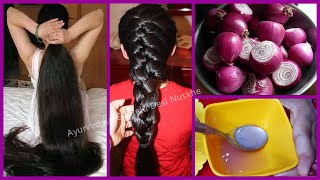 प्याज में बस ये मिला लो बाल इतने लम्बे मोटे हो जायेंगे की सब चौंक जायेंगे  How to Grow Hair Fast [upl. by Mensch774]