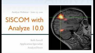 SISCOM with Analyze 100  Webinar [upl. by Ruprecht]