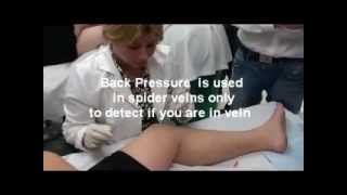 Sclerotherapy Training Certification mp4 [upl. by Mccormac]