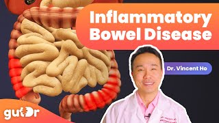 Inflammatory Bowel Disease IBD  The GutDr Explains 3D Gut Animation [upl. by Llerref390]