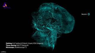 Human brain organoid immunolabeled cleared and imaged using Miltenyi Biotec’s 3D imaging workflow [upl. by Awad782]