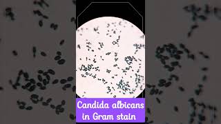 Candida albicans in Gram stain [upl. by Mchenry]