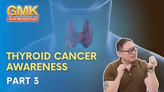 Thyroid Cancer Awareness Part 33  Usapang Pangkalusugan [upl. by Oriane]