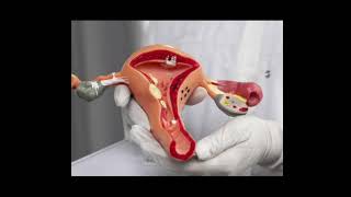 fallopian tube in female ka most important video hai [upl. by Adieno951]