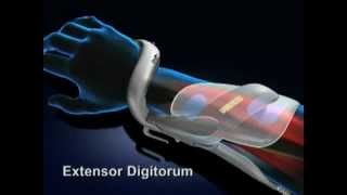 Bioness NESS H200 Hand Rehabilitation System Overview Rx Only [upl. by Annala]