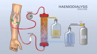 HAEMODIALYSIS DIALYZER [upl. by Azilef386]