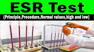 Erythrocyte sedimentation rate  ESR PrincipleProcedureNormal valueshigh and low [upl. by Suzetta]