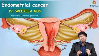 Endometrial Cancer  Obstetrics and gynaecology Video lectures Version 20  Medvizz app [upl. by Nauqit235]