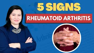 5 Signs of Rheumatoid Arthritis That You Should Not Ignore [upl. by Alyakcm828]