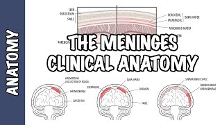 Clinical Anatomy  Meninges Intracranial hematoma subdural epidural subarachnoid and meningitis [upl. by Alvin]