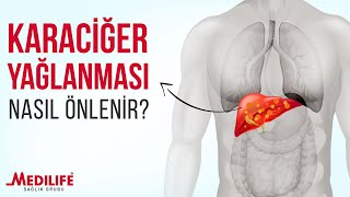 Karaciğer yağlanması nasıl önlenir [upl. by Leuams]