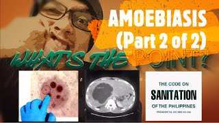 AMOEBIASIS Part 2 of 2  amoebic liver abscess diagnosis and treatment [upl. by Louise183]