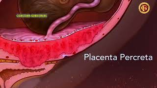 Embryology  Development of the Placenta  How is placenta developed [upl. by Solotsopa]