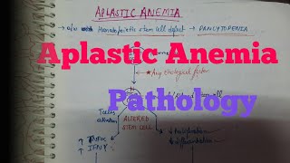 Aplastic anemia Pathology [upl. by Dowdell798]