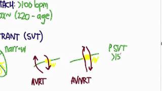 ACLS 09  Tachycardia 2 [upl. by Aisetal]