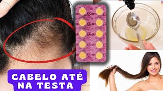 NÃƒO USE MUITO CRESCE CABELO MUITO RÃPIDO PARA DE CAIR E ALINHA [upl. by Raynell]