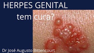 HERPES GENITAL tem cura [upl. by Lilithe]