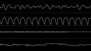 Jogeir Liljedahl  “Addiction” Amiga MOD Oscilloscope View [upl. by Velvet]