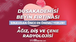 DUSAKADEMİSİ BEYİN FIRTINASI  Radyoloji Sınavdan Önce En Önemli Yerler [upl. by Annim]