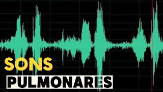 Ausculta pulmonar lung sounds  som normal sibilos estertores creptantes estridor traqueal [upl. by Kotick]