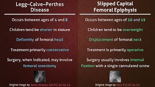 Legg–Calve–Perthes Disease vs Slipped Capital Femoral Epiphysis [upl. by Jandel]