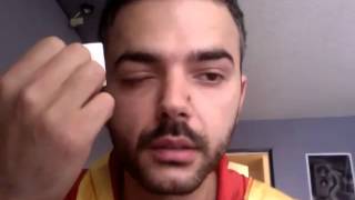 How I treat and heal pink eye conjunctivitis part 1 [upl. by Tedmann995]