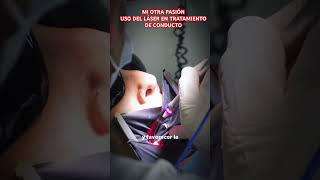 LÁSER EN ODONTOLOGIA fishing fish argentina fishingvideo amigos pesca pescaria laser dental [upl. by Oisor]