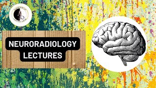 Tumors of the spine Part 1  Prof Dr Nahed Abdelgaber [upl. by Auric]