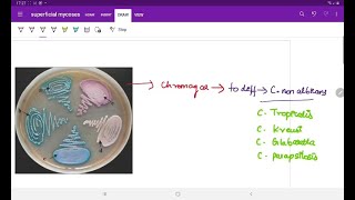 Oppurtunistic Mycoses  Microbiology  Image based discussion [upl. by Adrien]