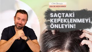 Saçlarda Kepeklenme Neden Olur Nasıl Önlenir [upl. by Rosenkranz]