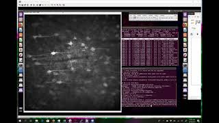 Imagejbased ROI Drawing for 2Photon Calcium Imaging Preprocessing [upl. by Rickey]