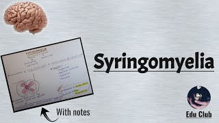 Syringomyelia  CNS Physiology [upl. by Andaira820]