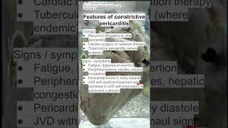 Features of constrictive pericarditis [upl. by Eceerehs]