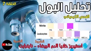 Urinalysis 7 Chemical ex Leukocyte esterase  Nitrite [upl. by Aioj173]