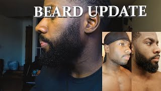 Beard Journey Update [upl. by Nahtnahoj]