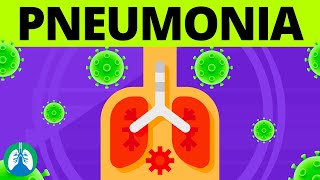 Pneumonia Overview  Causes Symptoms Diagnosis and Treatment [upl. by Yoshiko]