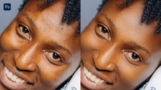 Blemish Removal In Photoshop 4 Methods To Try [upl. by Ahtela]