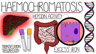 Understanding Haemochromatosis Hereditary amp Secondary [upl. by Magnus]